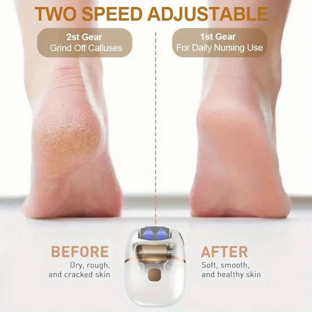 Electronic Pedicure Tool