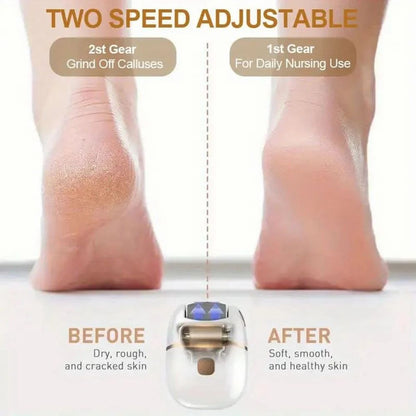 Electronic Pedicure Tool